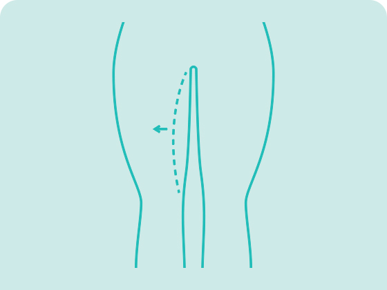 cirurgia plastica coxas dermolipectomia